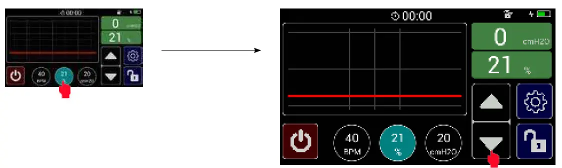 MTTS-Beluga-V1-Resuscitator-06