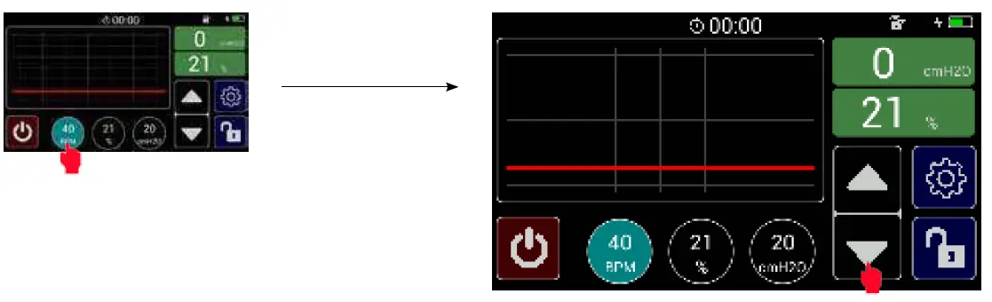 MTTS-Beluga-V1-Resuscitator-07