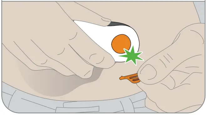 Dexcom G6 Personal CGM System - break off safety