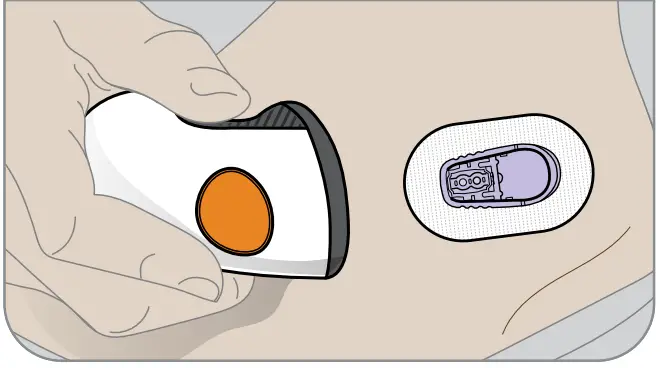 Dexcom G6 Personal CGM System - patch and holder