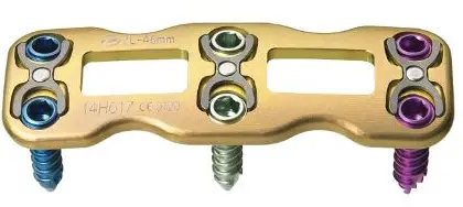 ORTHOFIX-Reliant-Anterior-Cervical-Plating-System-product-image