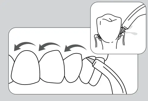 waterpik Water Flosser WP-100 Series - figure 7