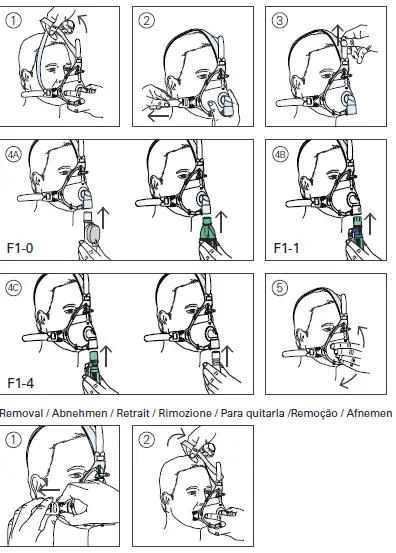 ResMed-AcuCare-F1-0-Hospital-Non-Vented-Full Face-Mask -fig 2