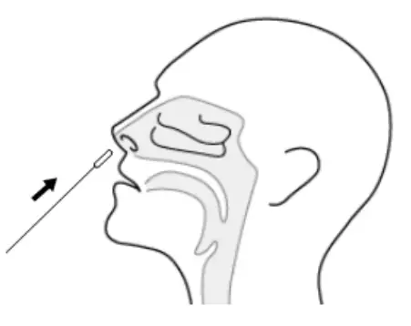 ACON SARS CoV 2 Rapid Antigen Test Leaflet - fig 1