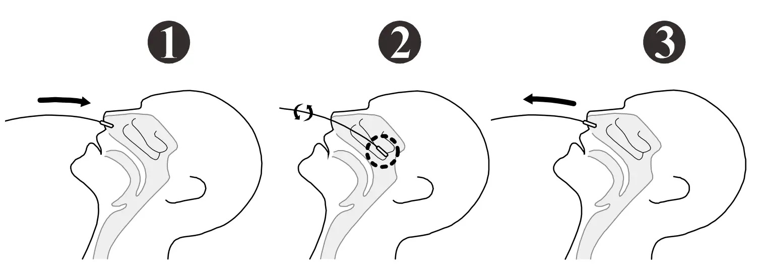 ACON SARS CoV 2 Rapid Antigen Test Leaflet - fig 5