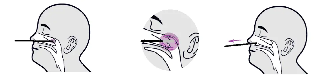Romed Coronavirus Antigen Rapid Test Cassette fig 1