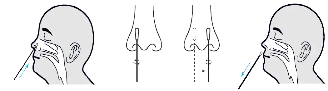 Romed Coronavirus Antigen Rapid Test Cassette fig 2