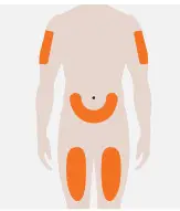 Nucala Injecting with the Autoinjector - Prepare2