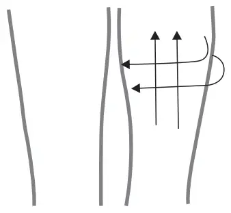 AAOCARE HKS909 Slim Tech Radio Frequency Vacuum Massage Roller - Thigh