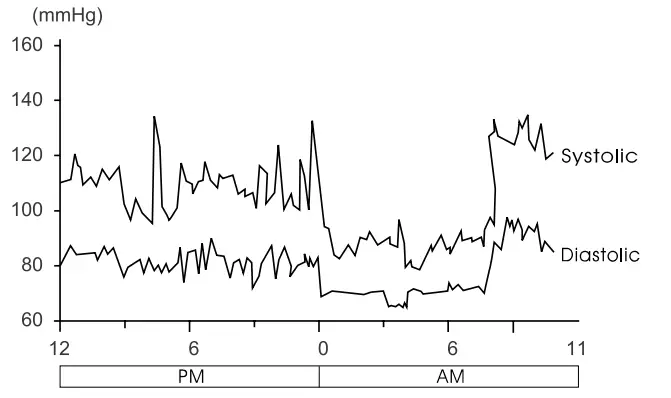 LUMISCOPE 1137 Blood Pressure Monitor Automatic Arm Type - Blood