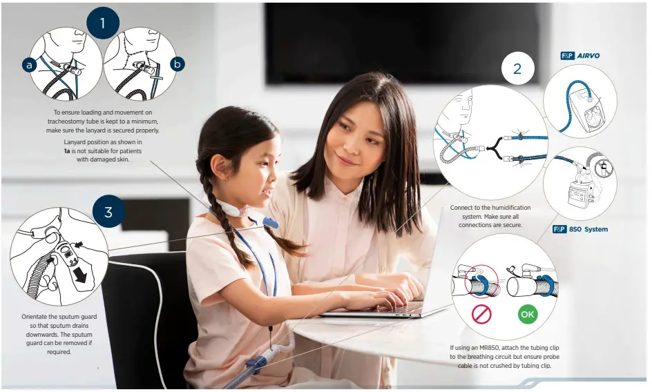 Respshop SUI-625321 Tracheostomy