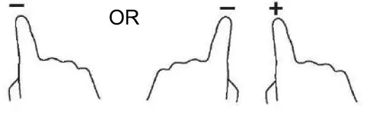 ROSIERES-RICD36C3D-E1-3-Burner-Induction-Hob-fig-16