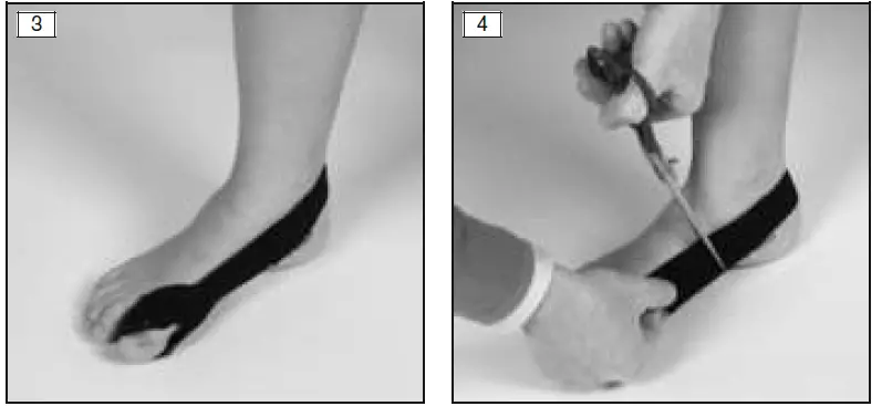 ottobock-509-Hallux-Valgus-02