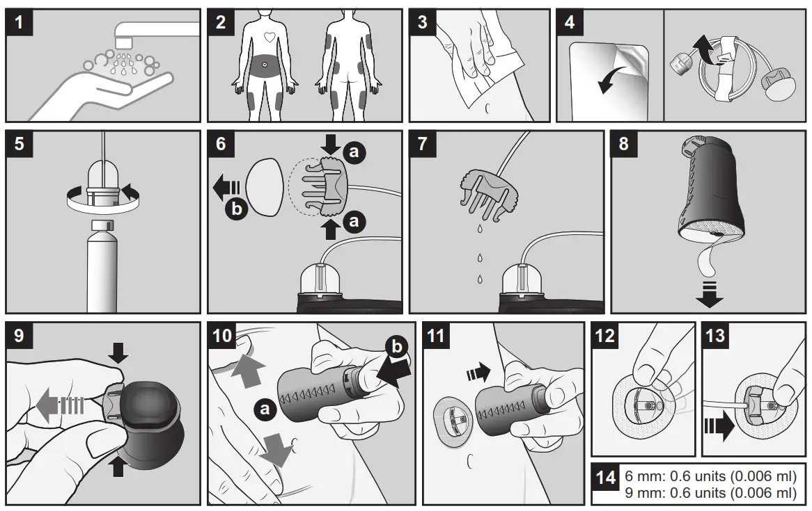 Medtronic Extended Infusion Set - FIG1