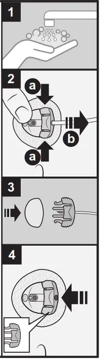 Medtronic Extended Infusion Set - FIG2