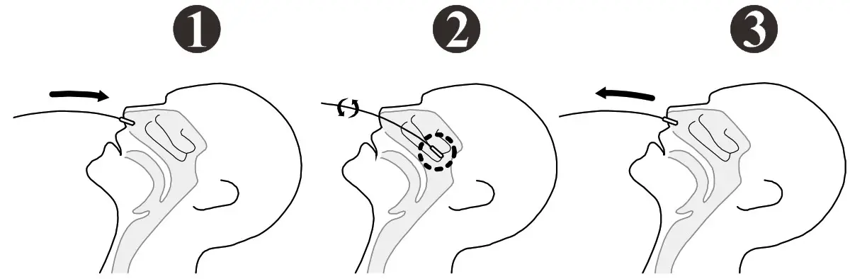 ACON SARS CoV 2 Antigen Rapid Test Package Insert - How to collect an anterior nasal swab sample 5