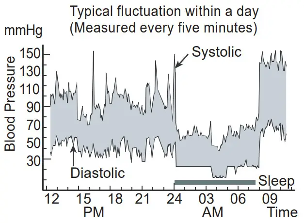 LAZLE WRS-35D Electronic Blood Pressure Monitor - Typical fluctuation