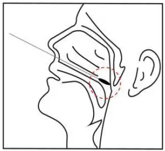 GenBody COVID-19 Ag Rapid Diagnostic Test for the Detection of SARS-CoV-2 Antigen 1