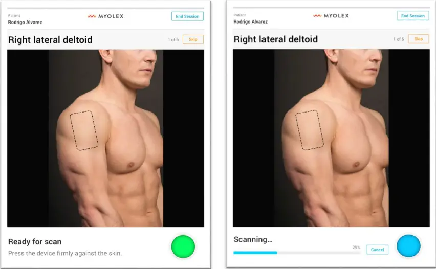 MYOLEX-mScan-System-fig11