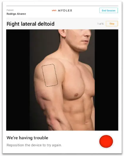 MYOLEX-mScan-System-fig12