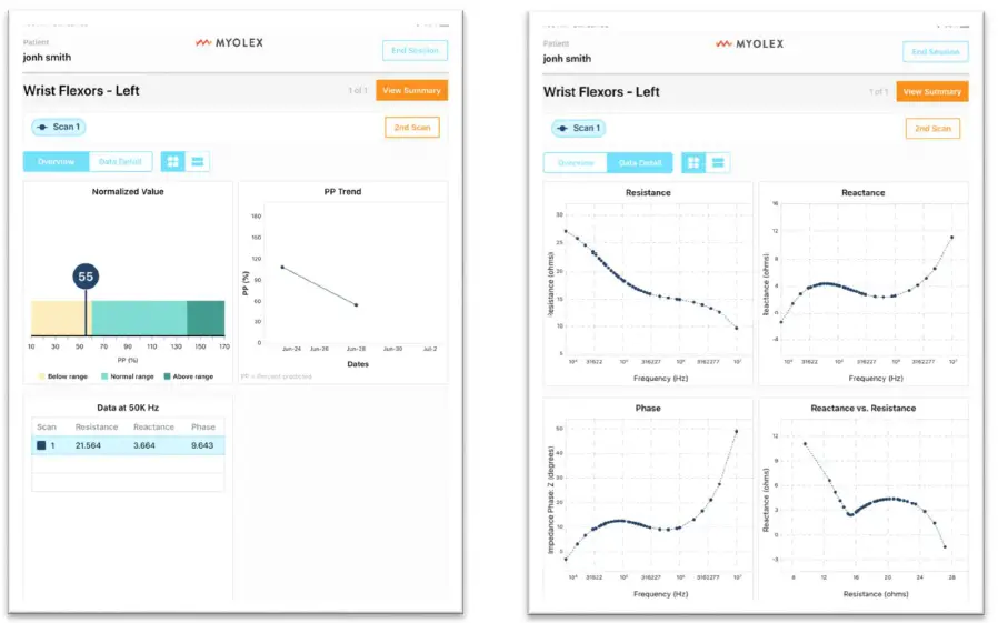 MYOLEX-mScan-System-fig13.