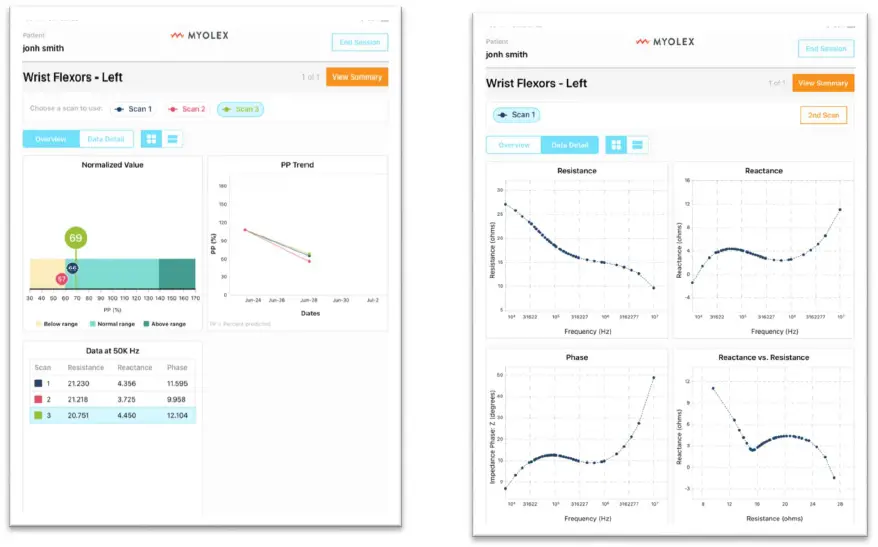 MYOLEX-mScan-System-fig15
