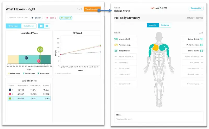 MYOLEX-mScan-System-fig16