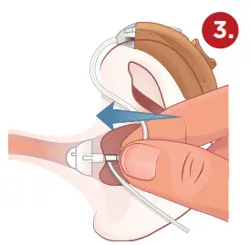 otofonix HELIX Hearing Amplifier-Insert ear