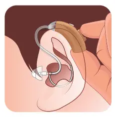 otofonix HELIX Hearing Amplifier-Tips to Change