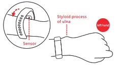 imperii RR FIERRO SmartBand Alcides - mathod