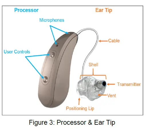 earlens IFU00037 Contact Hearing Solution fig 3