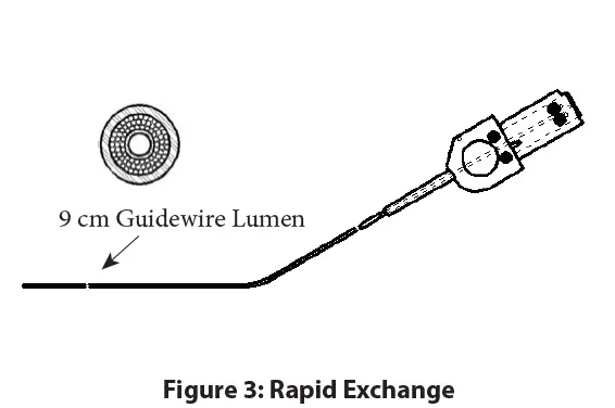 Spectranetics-ELCA-OTW-and-RX-Catheter-Models-fig3