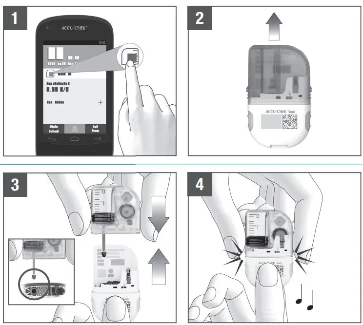 ACCU-CHEK-IUT526-Pump-Base-FIG2