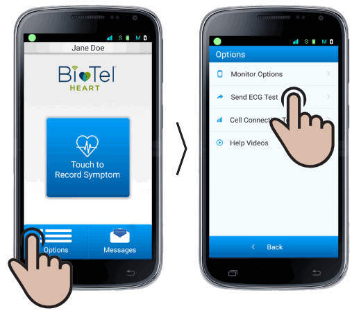 MCOT BIOTEL LEAD WIRE ADAPTER - 15