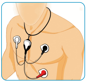 MCOT BIOTEL LEAD WIRE ADAPTER - 20