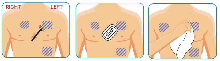 MCOT BIOTEL LEAD WIRE ADAPTER - 3
