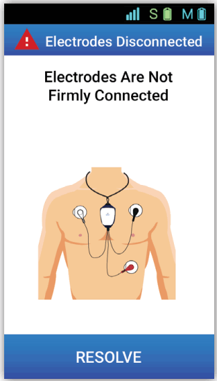MCOT BIOTEL LEAD WIRE ADAPTER - 37