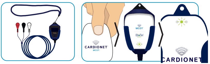 MCOT BIOTEL LEAD WIRE ADAPTER - 4