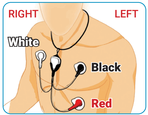MCOT BIOTEL LEAD WIRE ADAPTER - 8