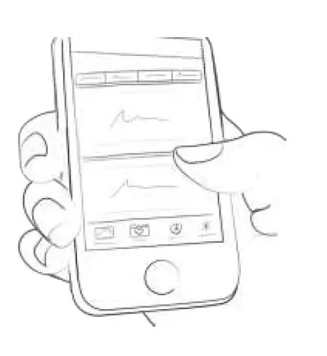 mySugr- Logbook -and- Continuous -Glucose -Monitor- fig 74