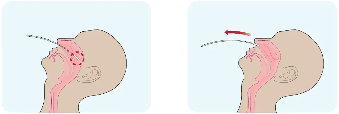 CareStart -RCHM-02071 -Covid-19- Antigen -12