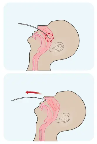 CareStart -RCHM-02071 -Covid-19- Antigen -2