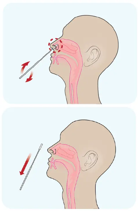 CareStart -RCHM-02071 -Covid-19- Antigen -4