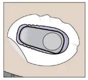 Dexcom G6 Pro Continuous Glucose Monitoring System-.icon27