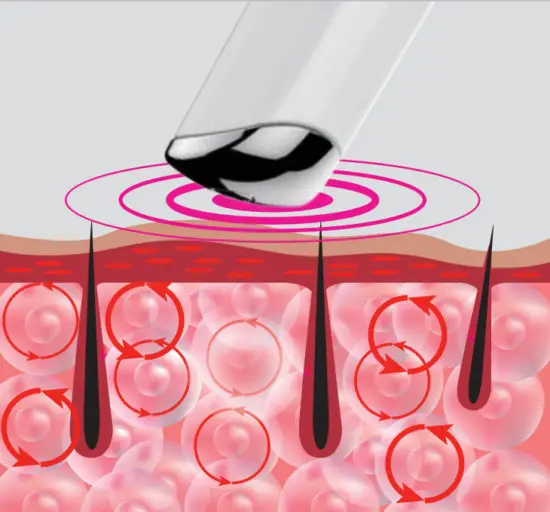 EvenSkyn Venus Premium Eyelid Anti Aging Device - fig6