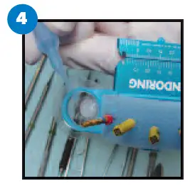 JORDCO ERK2-s Endoring II Hand-Held Endodontic -Instrument With -Gelwells fig 10