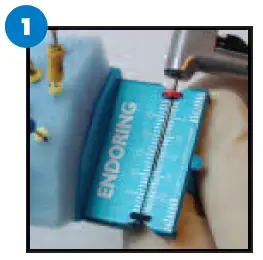 JORDCO ERK2-s Endoring II Hand-Held Endodontic -Instrument With -Gelwells fig 15