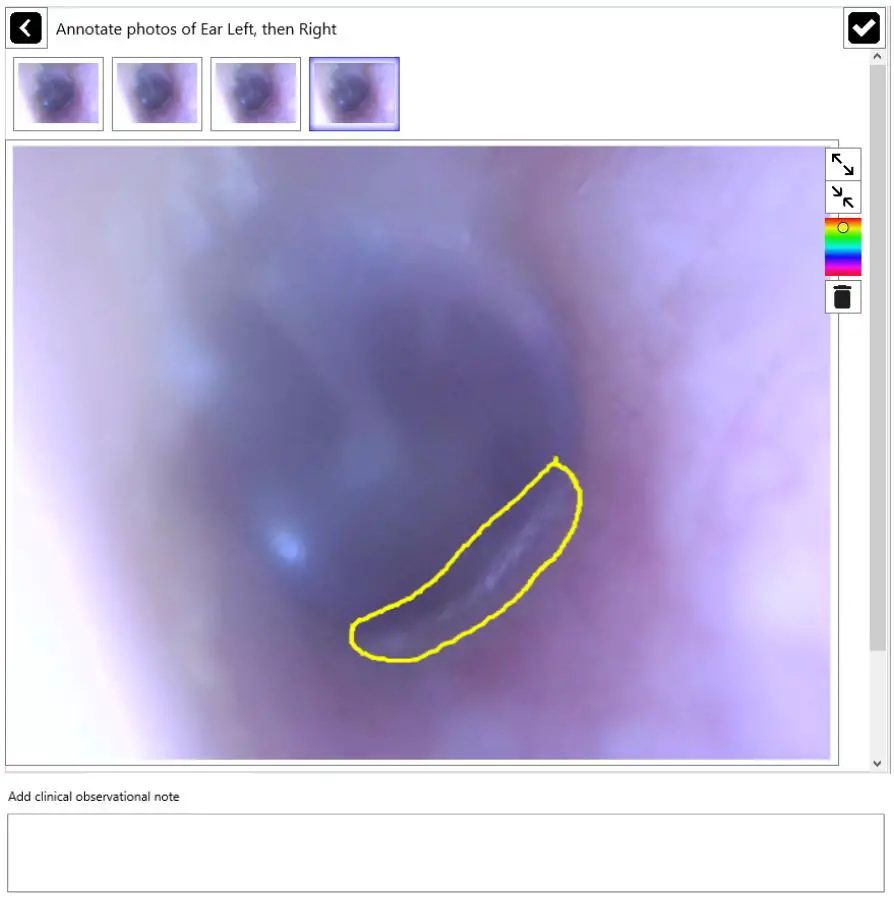 eMoyo TD0102 Kuduscope User Manual - Annotate photos of ear left then right