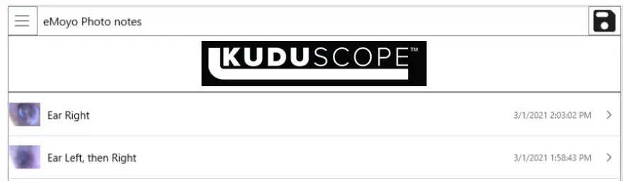 eMoyo TD0102 Kuduscope User Manual - Once all photos have been captured