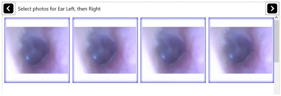 eMoyo TD0102 Kuduscope User Manual - Select Photos for Ear Left then Right